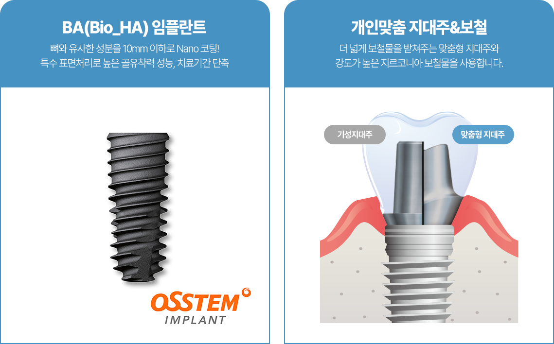 BA Bio-HA 임플란트와 개인 맞춤 지대주 및 보철 안내