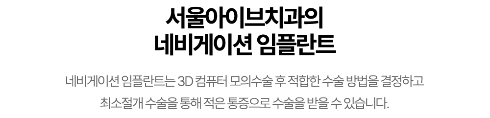 네비게이션 임플란트 안내